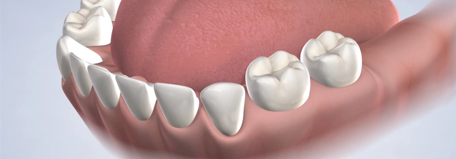 fillings-buildup-placement-procedure-desktop (1)