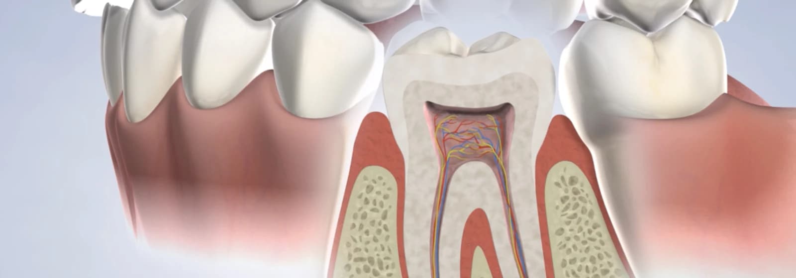 root-canal-procedure-desktop