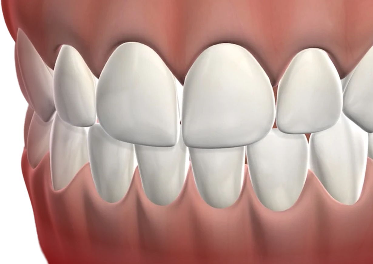 Longhorn Endodontics Image